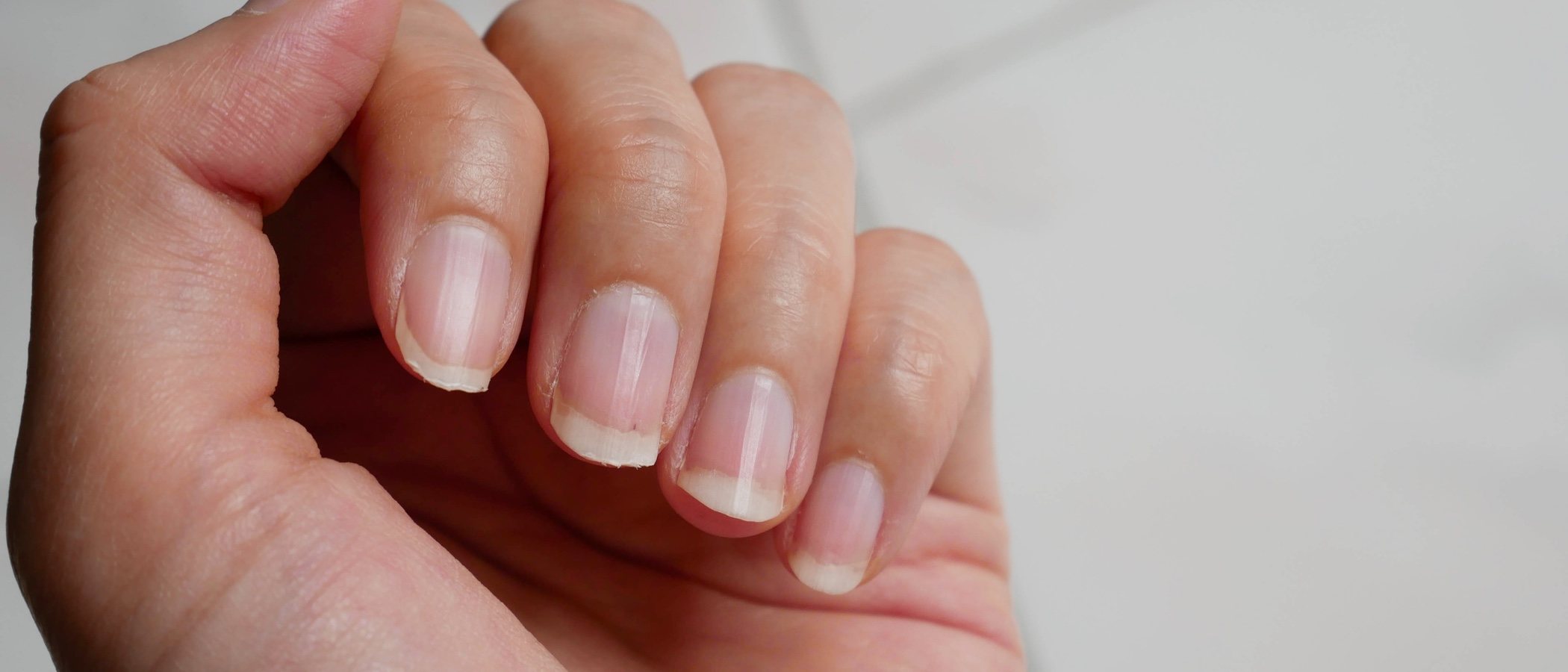Trucos para blanquear tus uñas