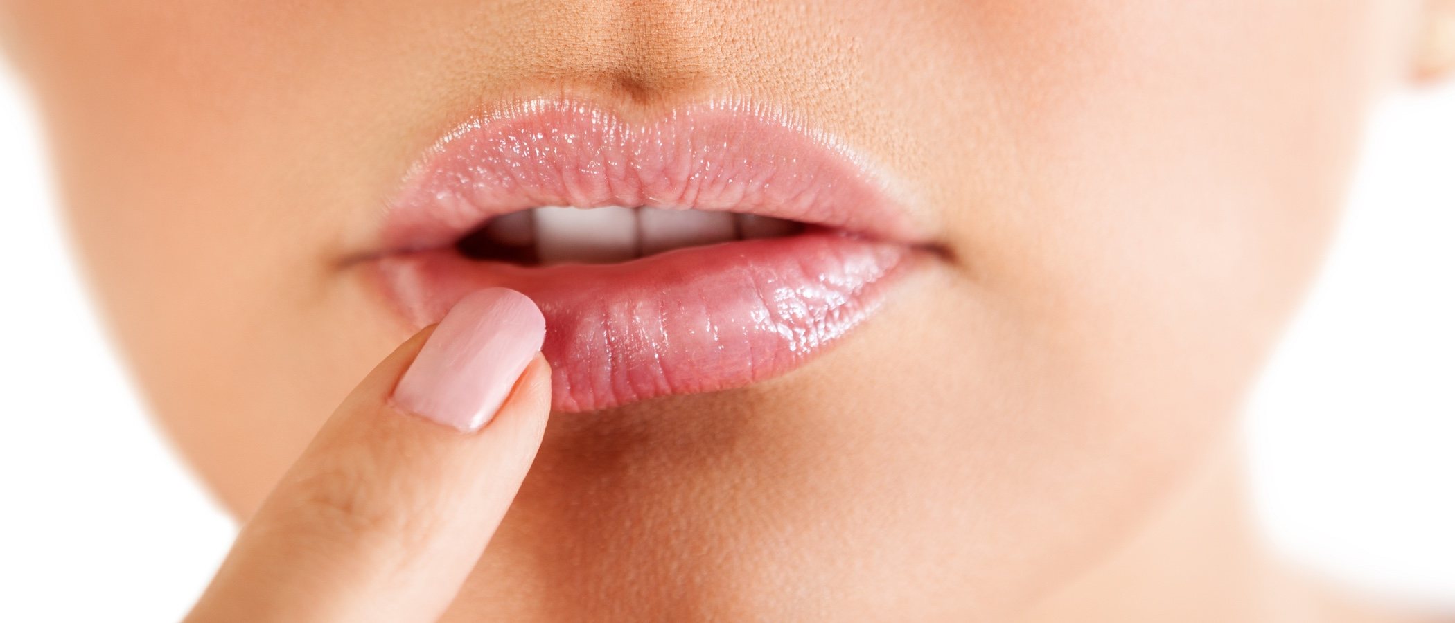Herpes facial: cómo eliminar y disimularlo