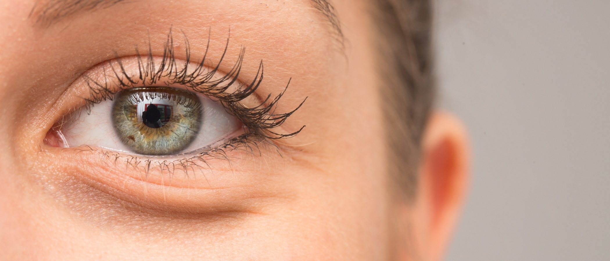 Consejos para reducir las bolsas de los ojos