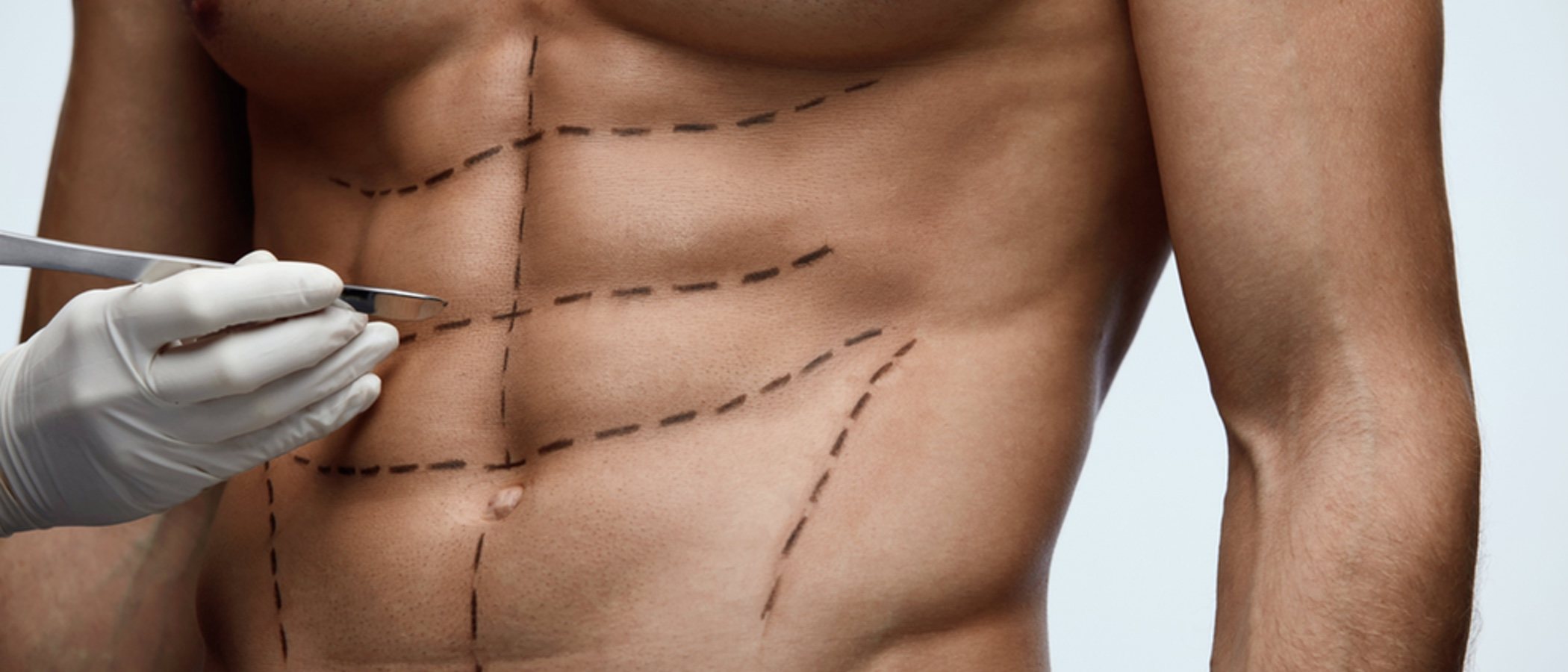 Cirugía estética para hombres: ¿qué me opero?