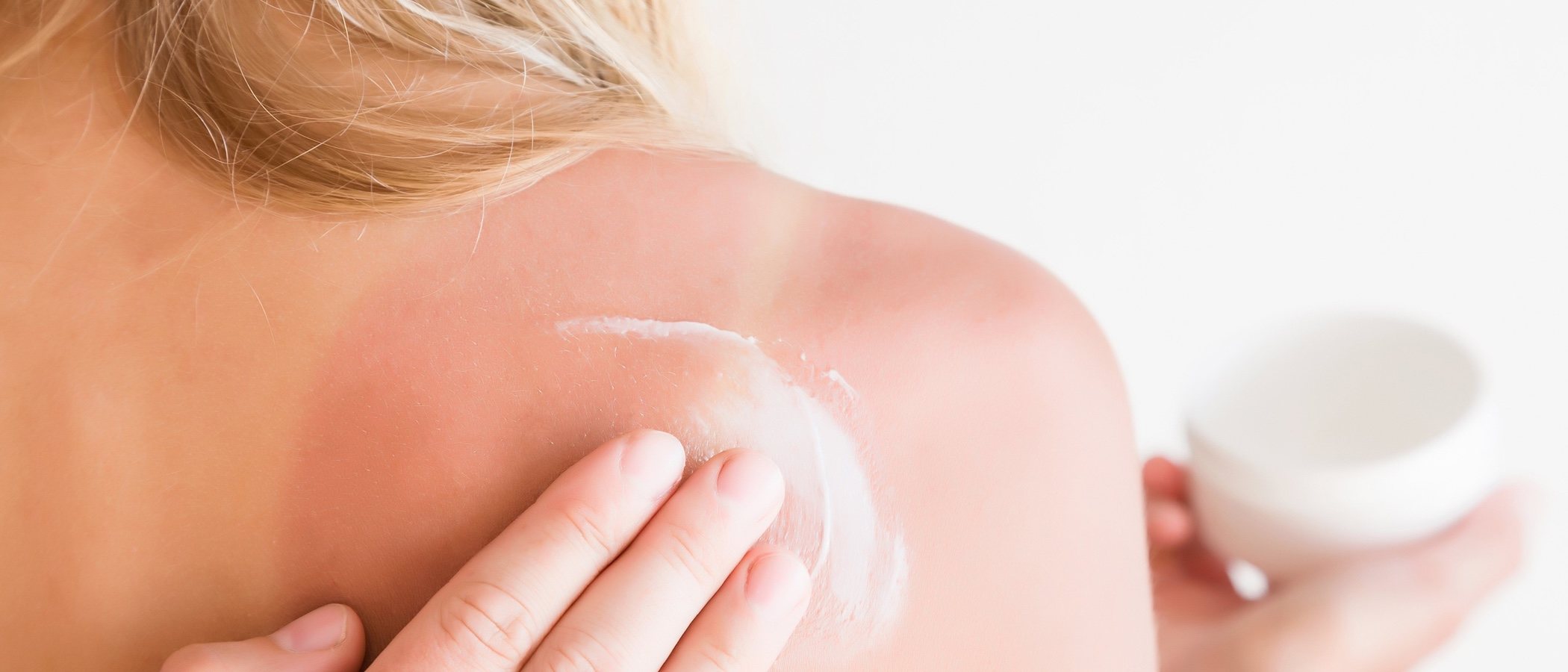 Protege tu cuello de las quemaduras solares