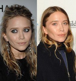 Mary-Kate Olsen y otras famosas que se operaron radicalmente el rostro