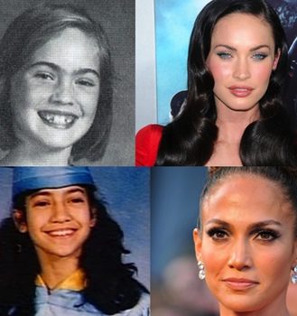Famosas y cirugía: el paso del tiempo también afecta a las celebrities
