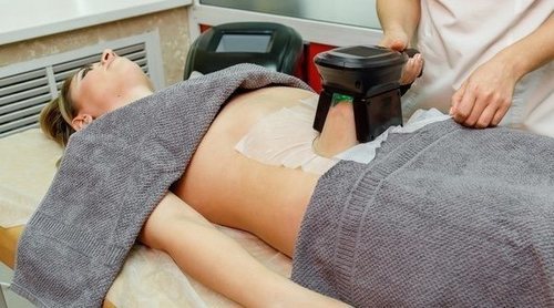 CoolSculpting: ¿en qué consiste esta técnica?