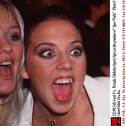 Melanie C antes de perfeccionar sus dientes