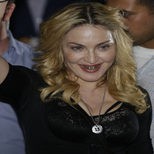 Madonna presume de dientes de oro